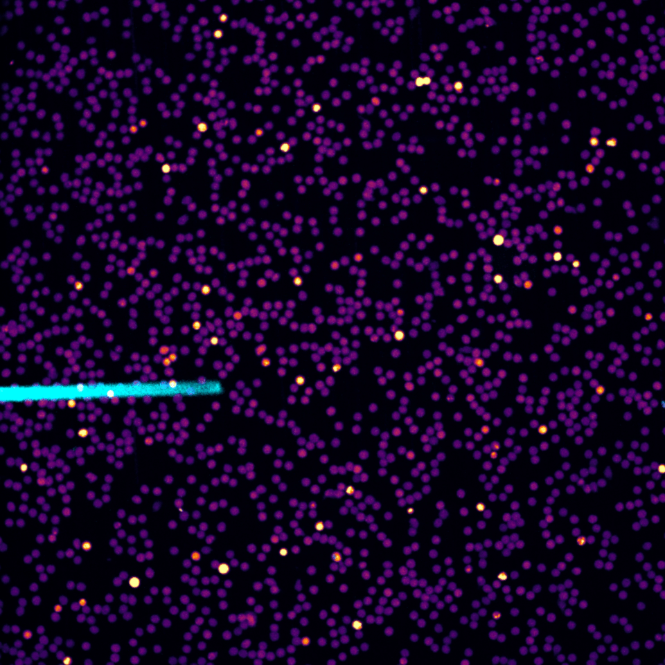 Neutrophils, a type of white blood cells, collectively migrate toward sites of infection during a process called swarming. Shown is a micropipette (blue) releasing a metabolite that triggers swarming in a dish of primary human neutrophils.