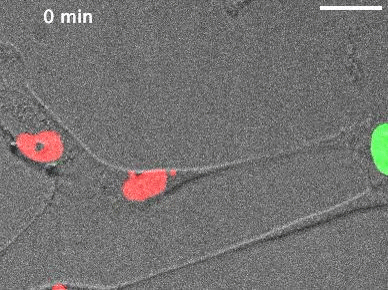 Live-cell microscopy shows a DNA-containing micronucleus (green) moving directly from one human cell into a nearby cell (red).
